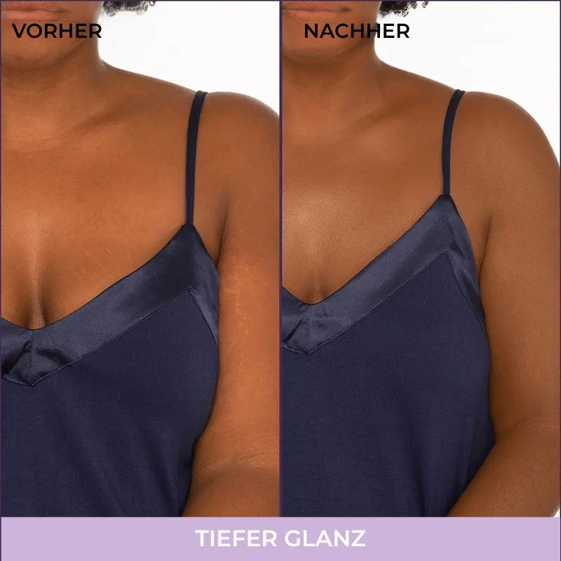 ScarRelief™ | Silicone littekenpleisters