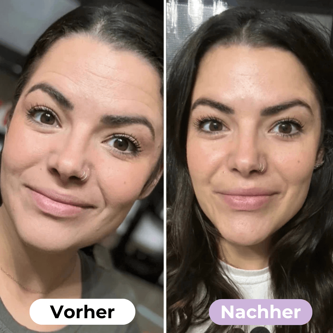 SmoothSkin™ Silicone rimpelpleisters