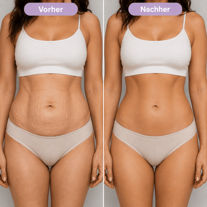 GlowShape™ | Ultraschall Körperstraffer