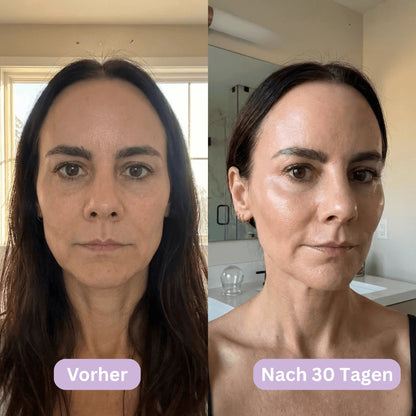 LymphCup™ | Lymphaktivierendes Gesichts-Kontur-System
