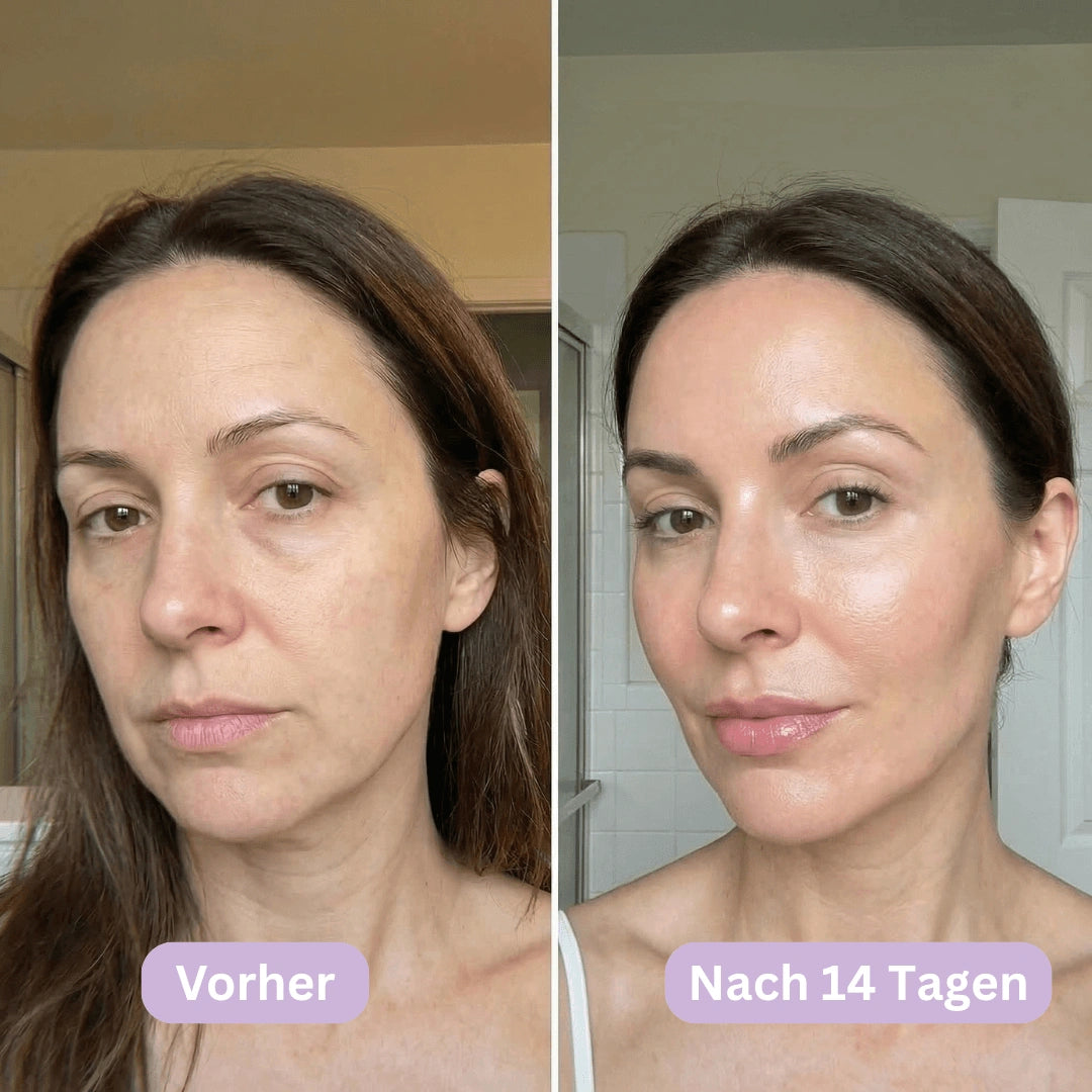 LymphCup™ | Lymphaktivierendes Gesichts-Kontur-System